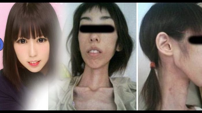 Wanita Jepang Ini Disiksa Kakeknya Hingga 20180210 170715