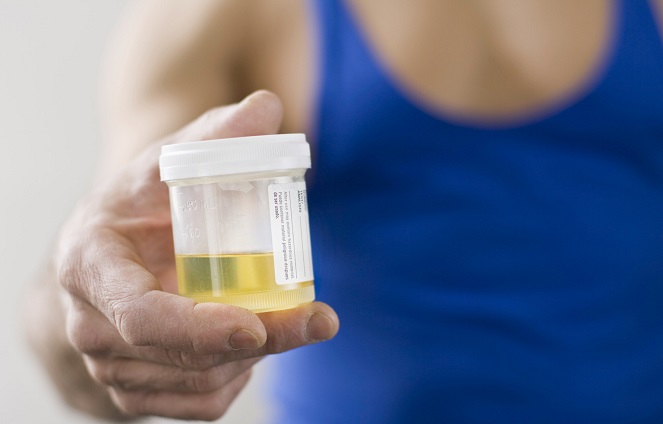 Bukan Narkoba, Inilah 6 Kecanduan Paling Aneh Di Dunia! Minum Urine