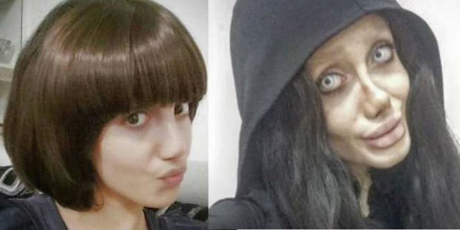 Lakukan Operasi Plastik 50 Kali Demi Mirip Angelina Jolie, Tapi Wajah Remaja Ini Malah Mirip Zombie! Dafunda Gokil