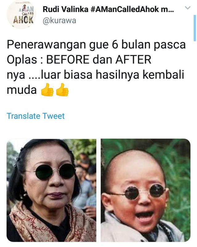 Ratna Sarumpaet Mengaku Bohong, Reaksi Kocak Netizen Ini Bikin Ngakak! Before After