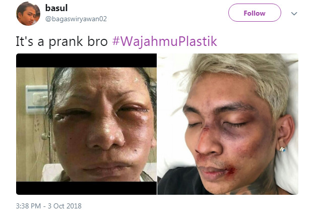 Ratna Sarumpaet Viral, Netizen Ramai Ramai Bikin Tagar #Wajahmuplastik Yang Lex 2