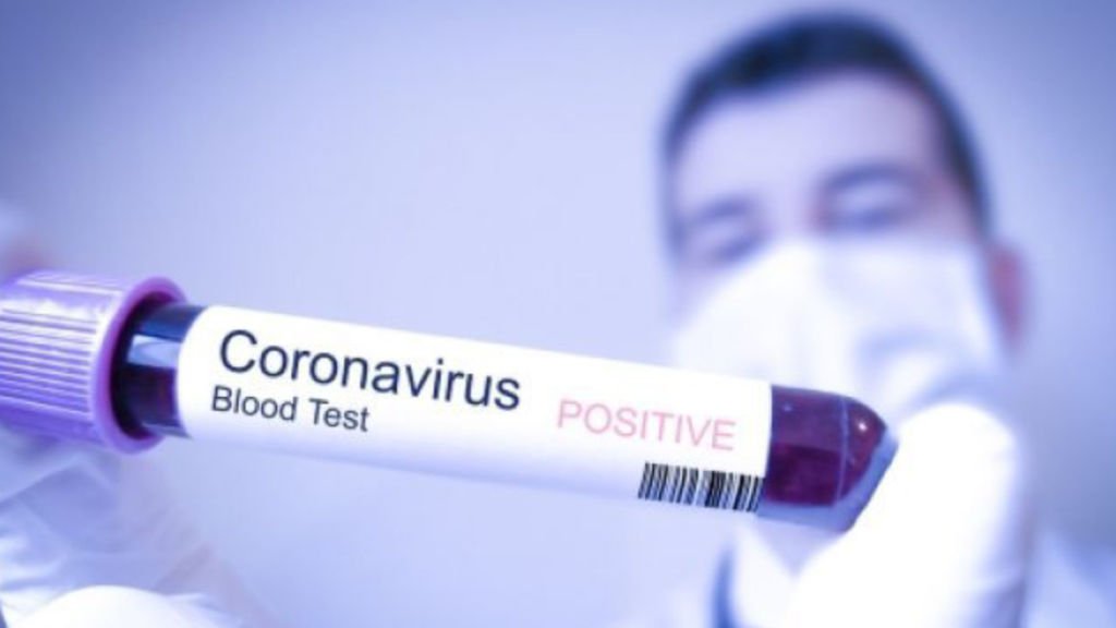 Asal Virus Corona