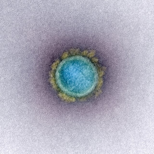 Wujud Virus Corona