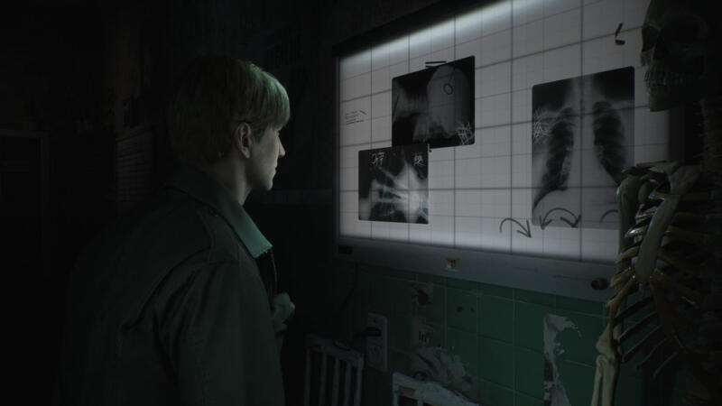 Fakta Silent Hill 2 Remake