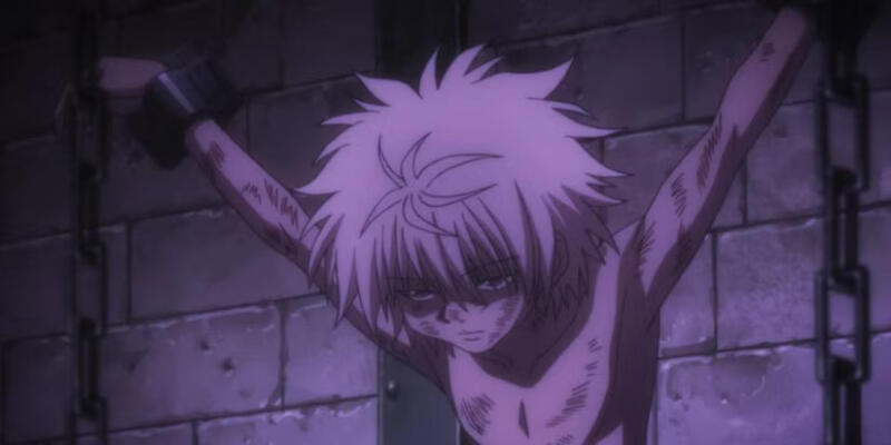 Killua Zoldyck