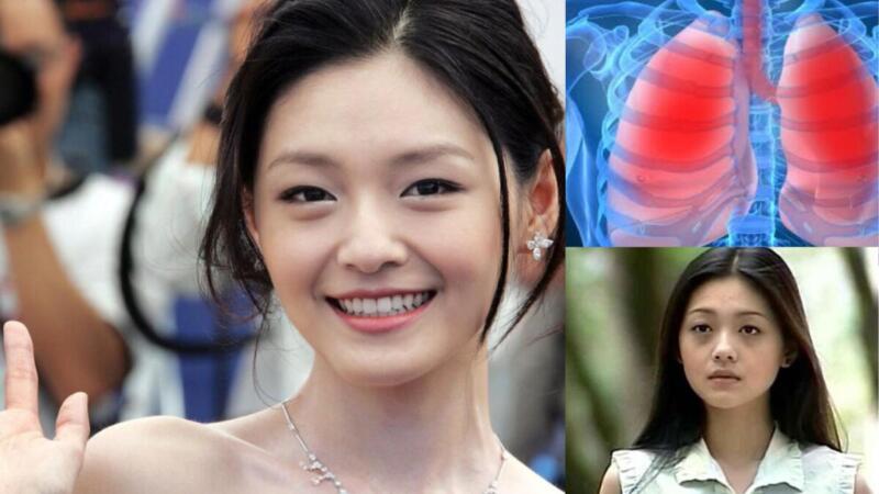 Image: Pneumonia Barbie Hsu